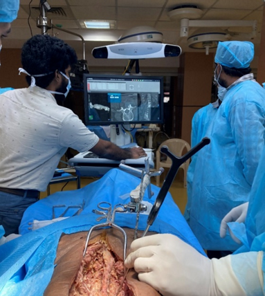 Optical tracking camera and navigation display in the operating room
