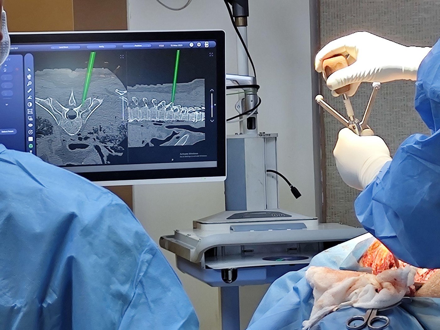 Surgeon reviewing the navigation display intraoperatively