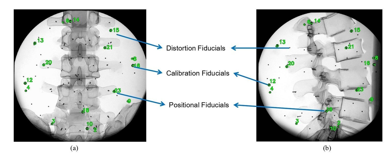 Automatic fiducial labeling on AP and LA views