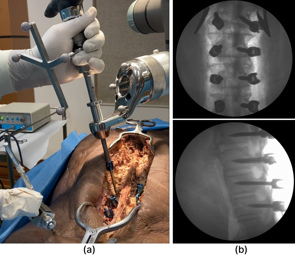 Cadaveric study setup and intraoperative verification