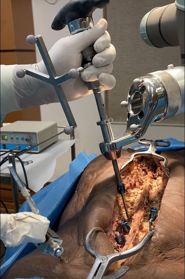Open procedure setup, close-up