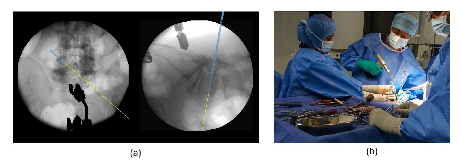 Live patient trial: tool tracking interface and surgical site